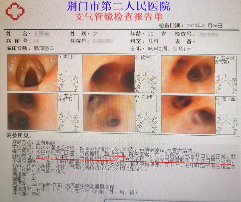 电子支气管镜检查、治疗、取样送检“一举多得”.jpg